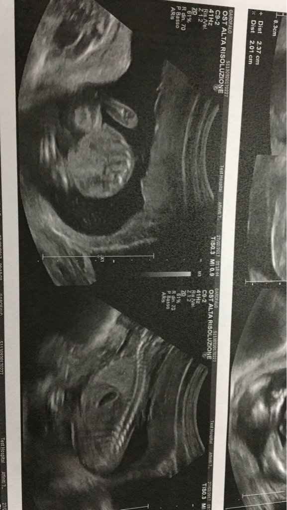 Morfologica e un po' di pensieri - 2