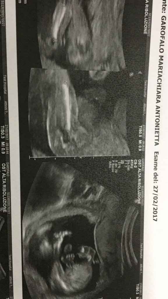 Morfologica e un po' di pensieri - 3