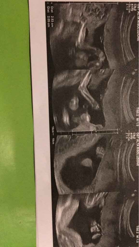 Morfologica e un po' di pensieri - 4