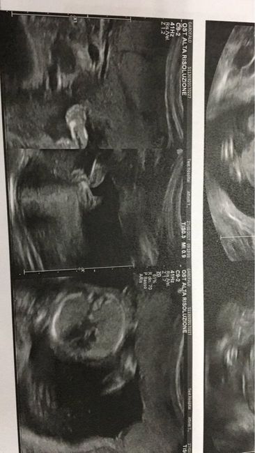 Morfologica e un po' di pensieri - 1