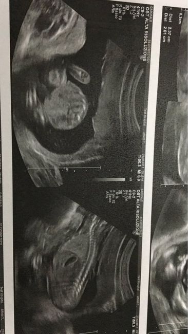 Morfologica e un po' di pensieri - 2