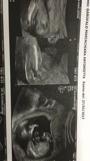 Morfologica e un po' di pensieri - 3