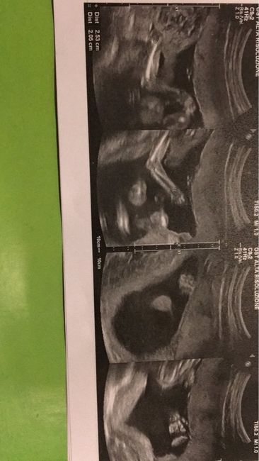 Morfologica e un po' di pensieri - 4