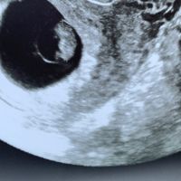 Future mamme ottobre 2020 - 1