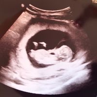 Esperte di Nub Theory a me - 1