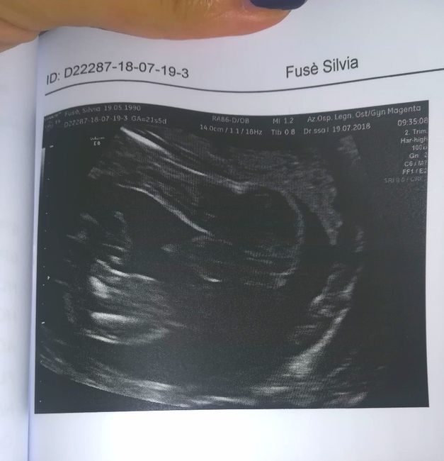 Ecografia con sesso evidente 1