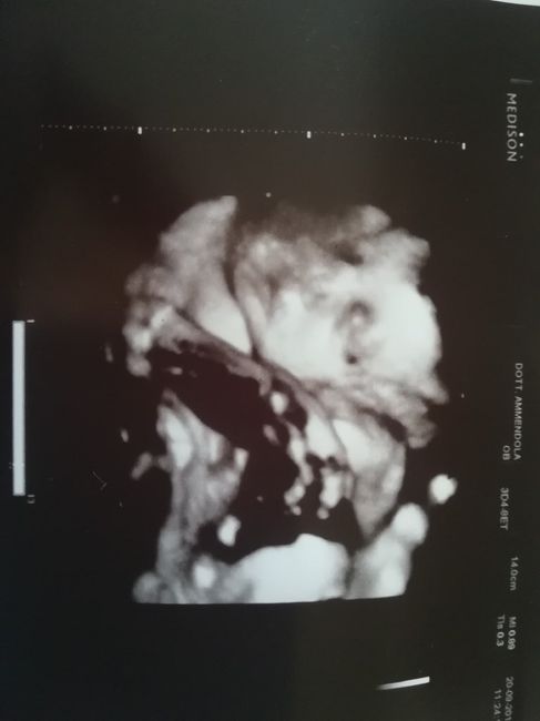Mamme di novembre 1