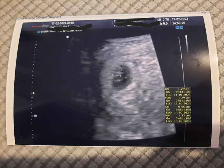 Prima ecografia - 1