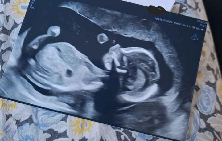 e si continua in 2 più forti di prima - 1