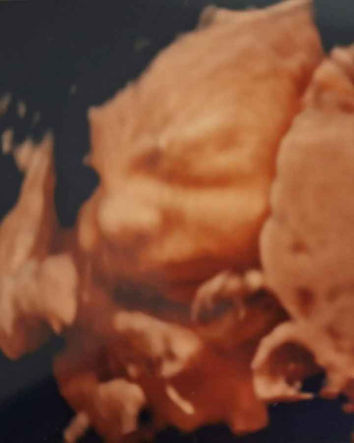 Benvenuto 8° mese - 1