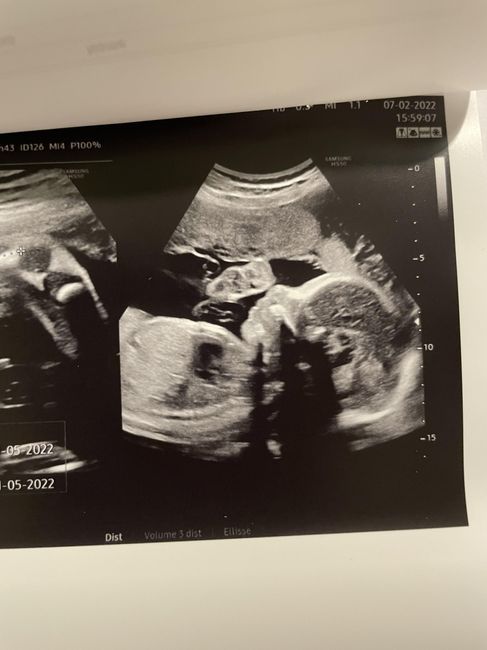💙💜future mamme di Maggio 2022💙💜 1