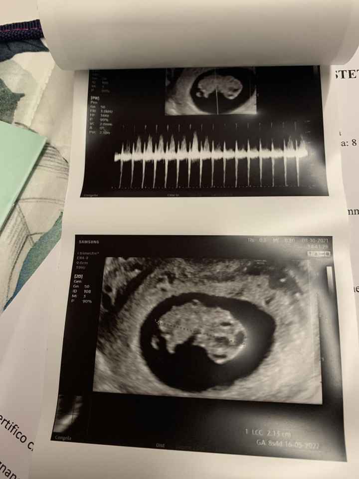 💙💜future mamme di Maggio 2022💙💜 6