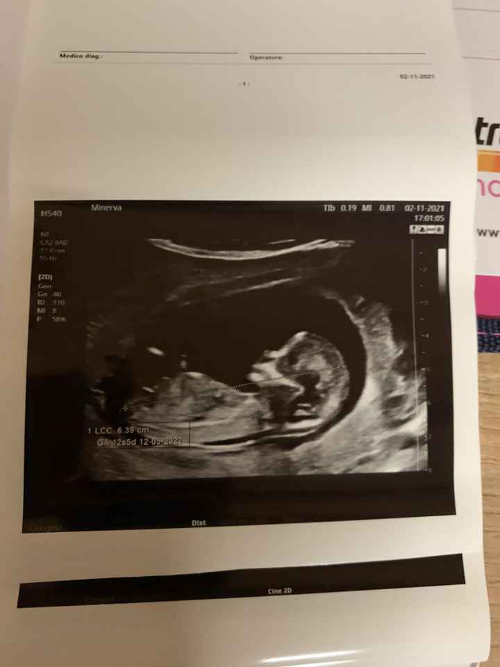 💙💜future mamme di Maggio 2022💙💜 4