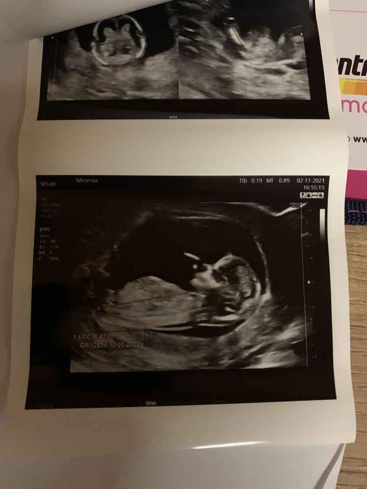 💙💜future mamme di Maggio 2022💙💜 5