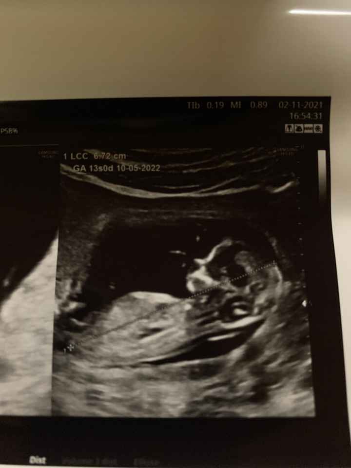 💙💜future mamme di Maggio 2022💙💜 1