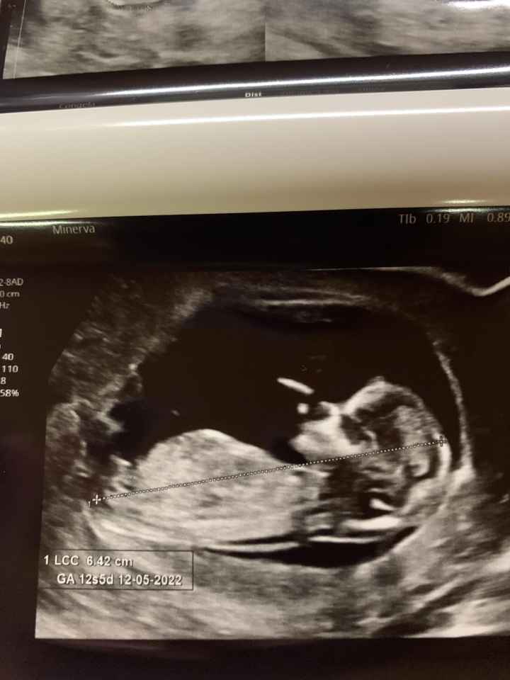 💙💜future mamme di Maggio 2022💙💜 2