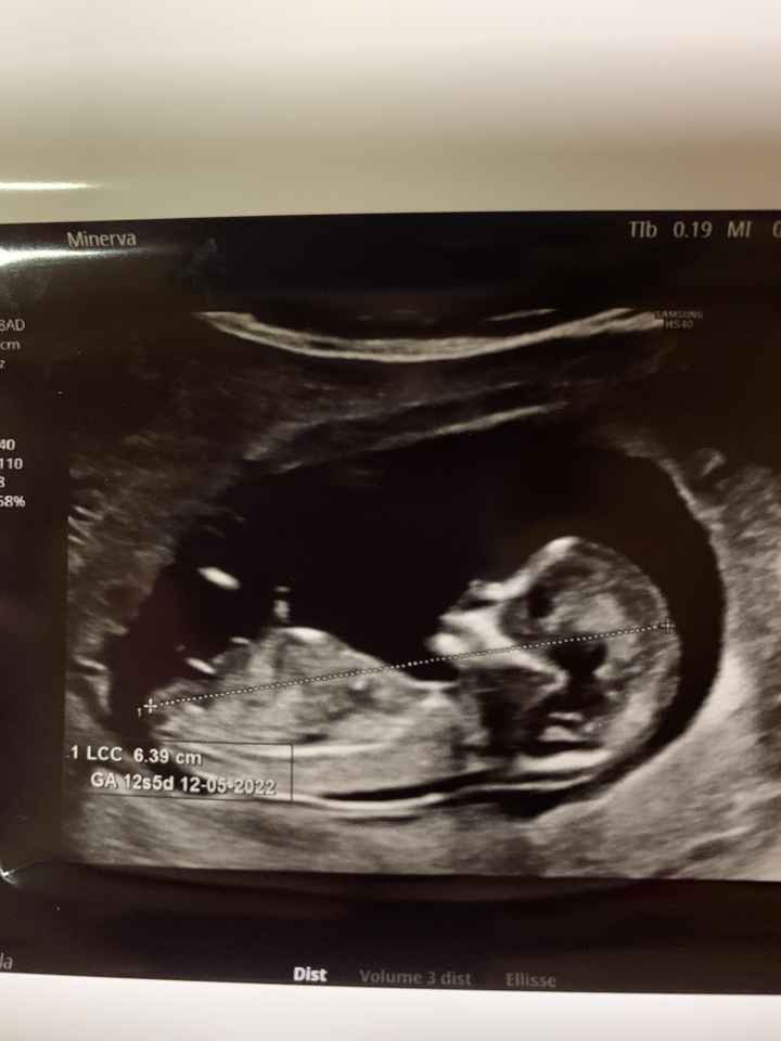 💙💜future mamme di Maggio 2022💙💜 3