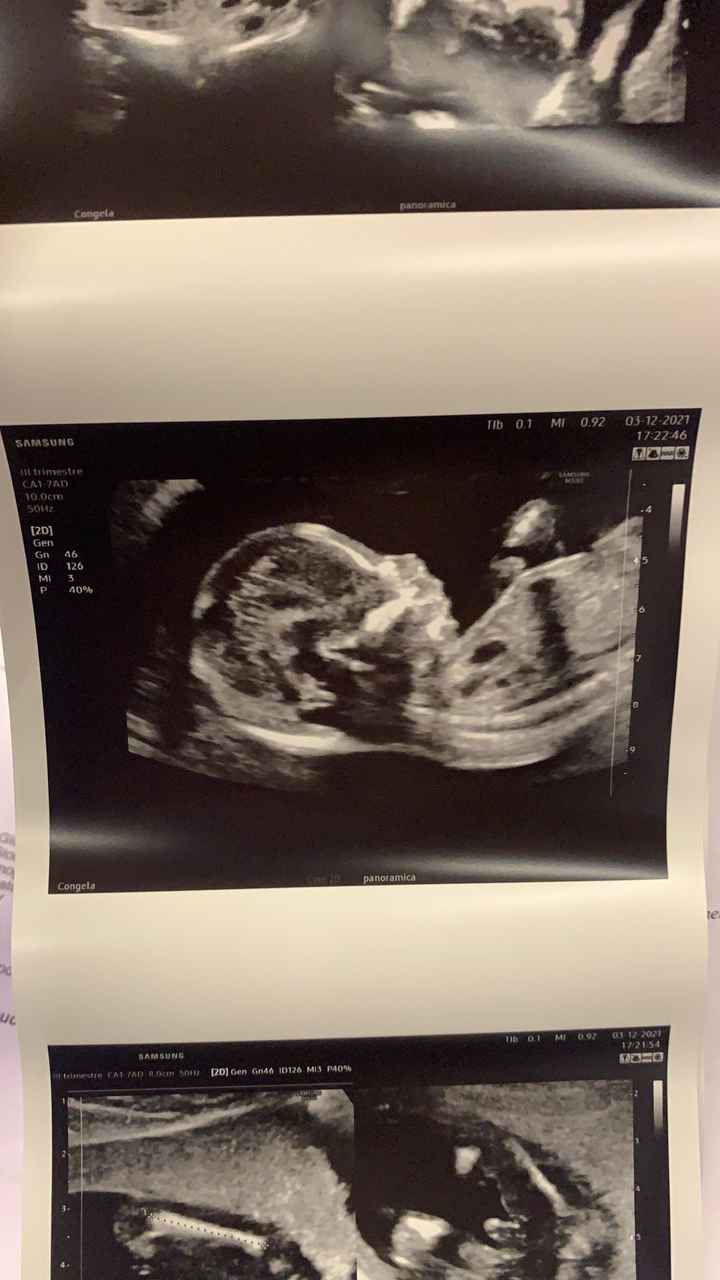 💙💜future mamme di Maggio 2022💙💜 1