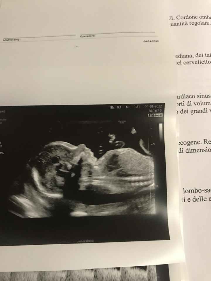 💙💜future mamme di Maggio 2022💙💜 2