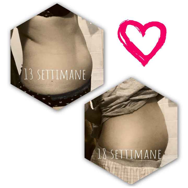 Questione pancia - 1