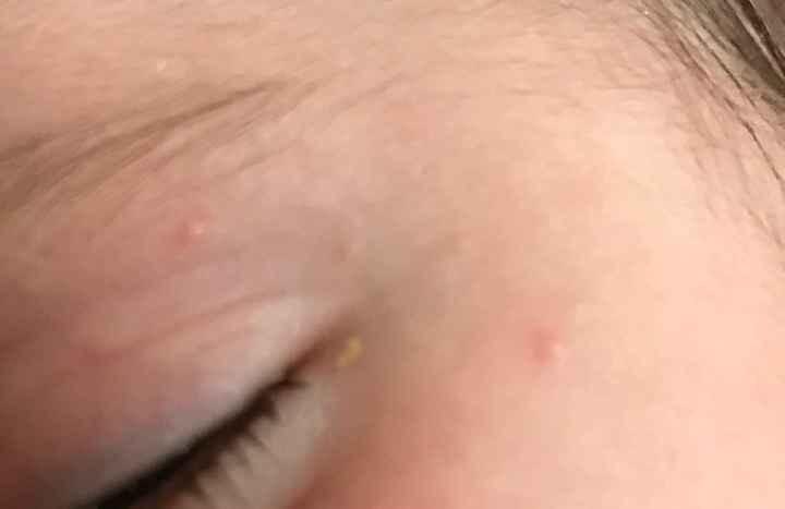 Beufoletti/puntini Rossi neonata - 1