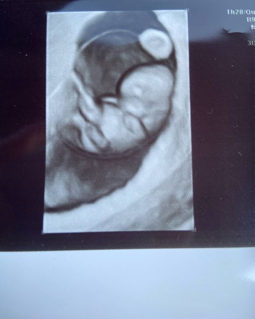 Future mamme ottobre 2022 - 1