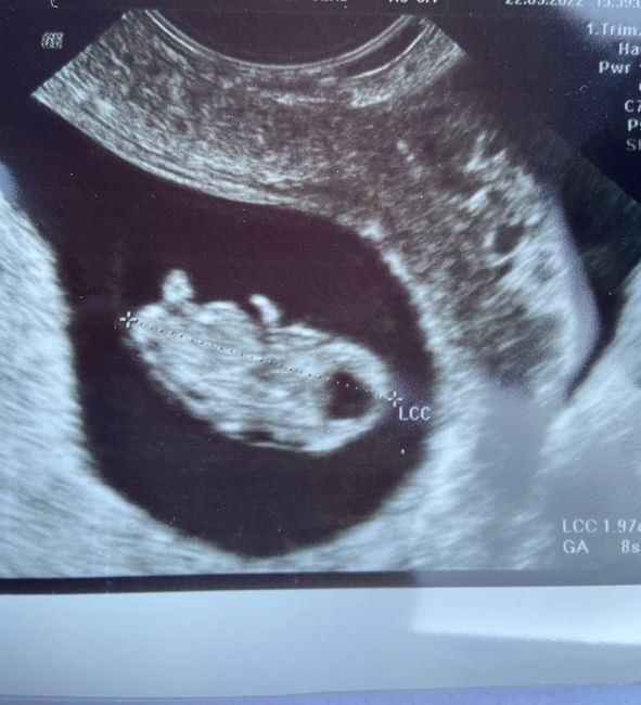 Future mamme ottobre 2022 - 2