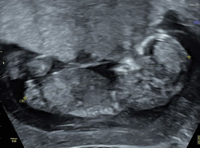 Nub theory, giochiamo un po’ - 1