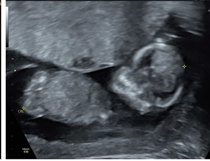 Nub theory, giochiamo un po’ - 2