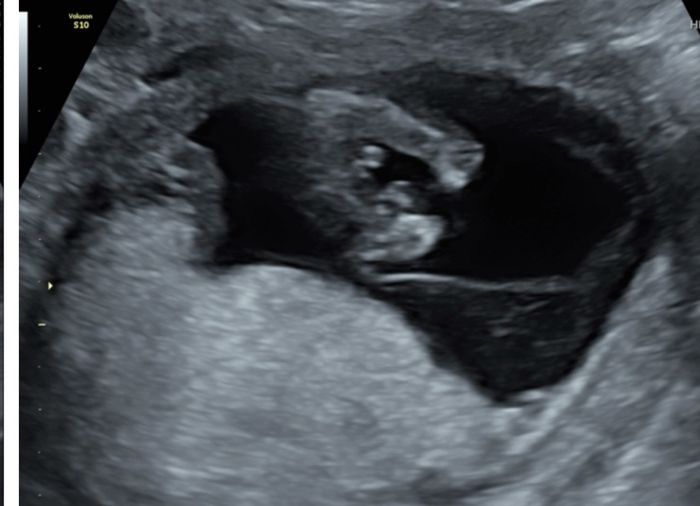 Nub theory, giochiamo un po’ - 3