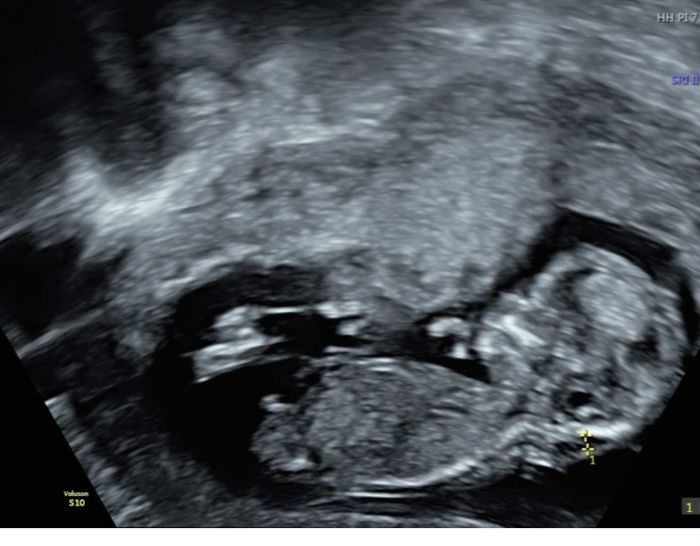 Nub theory, giochiamo un po’ 7