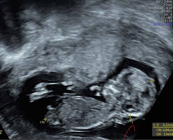 Nub theory, giochiamo un po’ 3