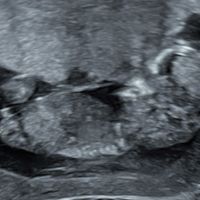 Nub theory, giochiamo un po’ - 1