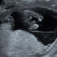 Nub theory, giochiamo un po’ - 3