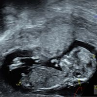 Nub theory, giochiamo un po’ - 1