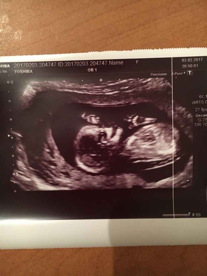 Mamme agosto 2017 - 1