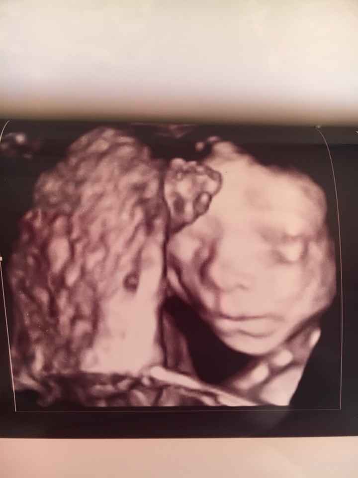 Mamme agosto 2017 - 1