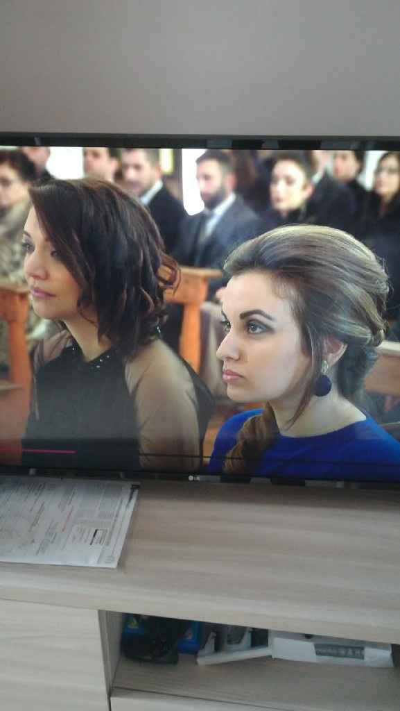 Intervento di rinoplastica matrimonio - 1