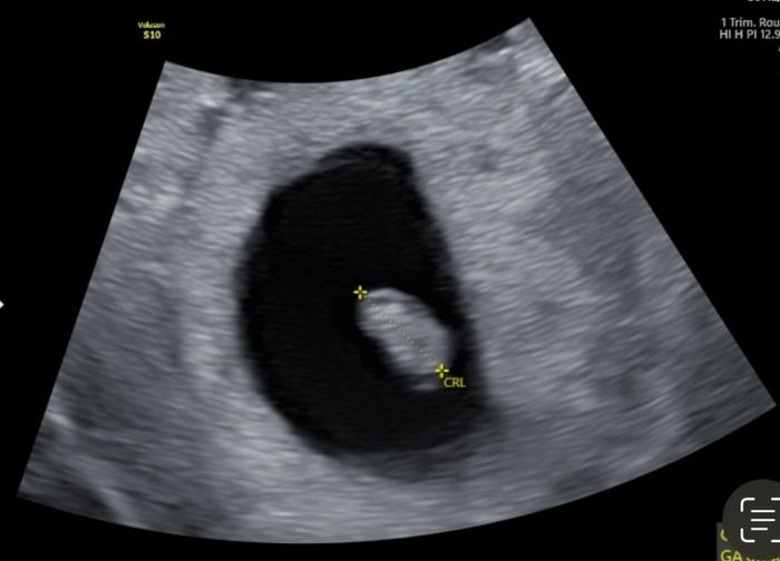 Future mamme Dicembre 2022 - 1