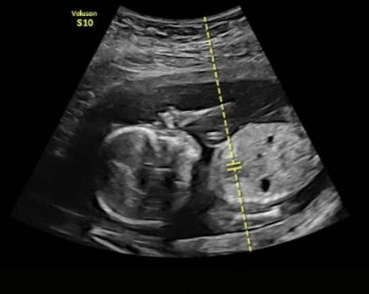 Future mamme Dicembre 2022 - 1