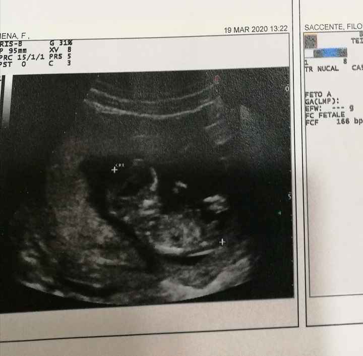 Ecografia,. Maschio o femmina? 5
