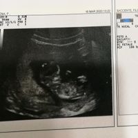 Ecografia,. Maschio o femmina? - 1