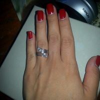 il mio anello di fidanzamento