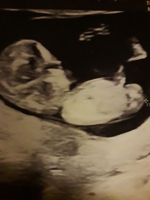 Esperte di Nub Theory a me 5