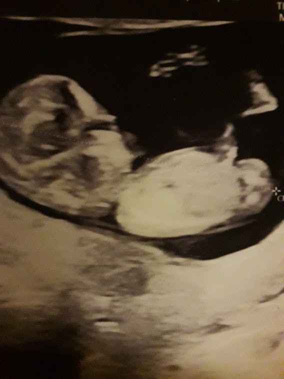 Esperte di Nub Theory a me - 1