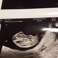 Metodo Ramzi è attendibile? - 1