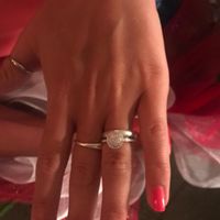 In che modo ti prendi cura del tuo anello di fidanzamento? - 1