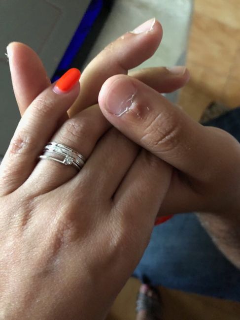 Anello proposta: mi fate vedere il vostro? 1