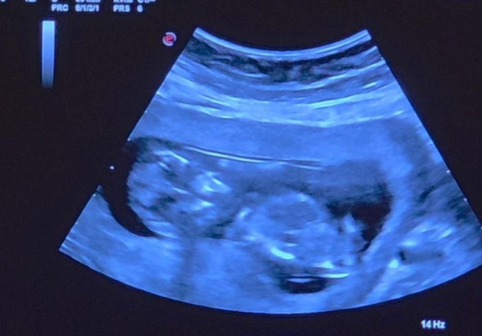 Esperte Nub Theory - 2