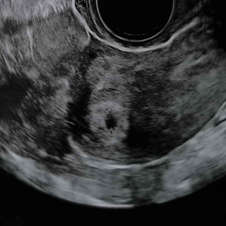 Chi non le aspetta x Gennaio 2021❤️💪🏻🤞🏻🎉🍀🍀 - 1